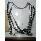 Ожирение . СССР .